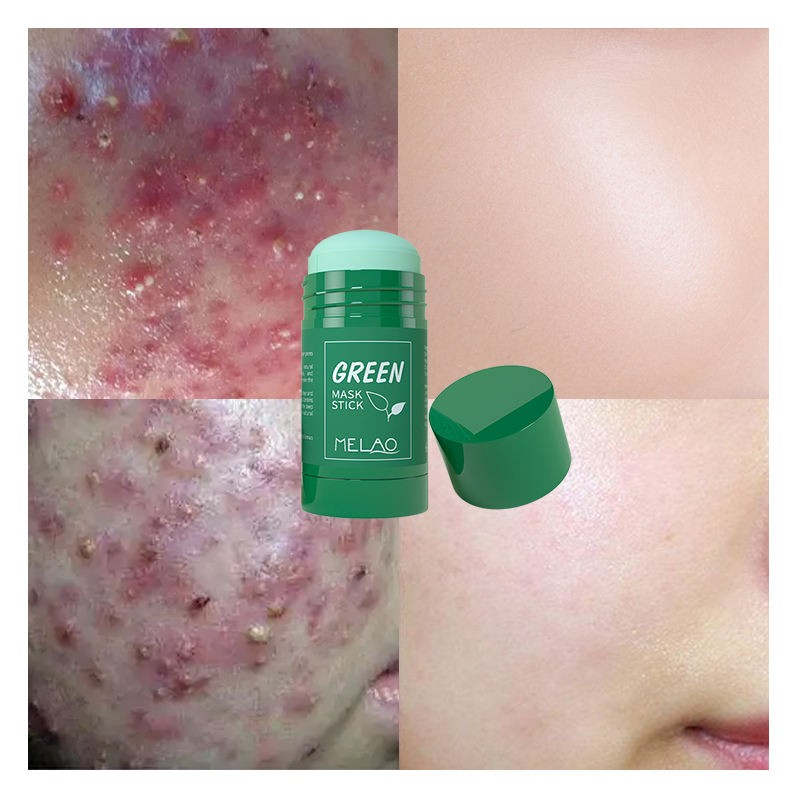 Melao Skin Repair Acne Remove Mud Mask Organic Green Tea Mask Stick Clay Mask Stick 40gFor Women