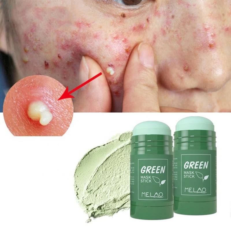 Melao Skin Repair Acne Remove Mud Mask Organic Green Tea Mask Stick Clay Mask Stick 40gFor Women