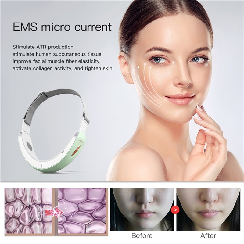 CkeyiN Chin V-Line Up Lift Belt Machine Blue LED Photon Therapy EMS Face Lifting Slimming Vibration Massager Double Chin Reducer