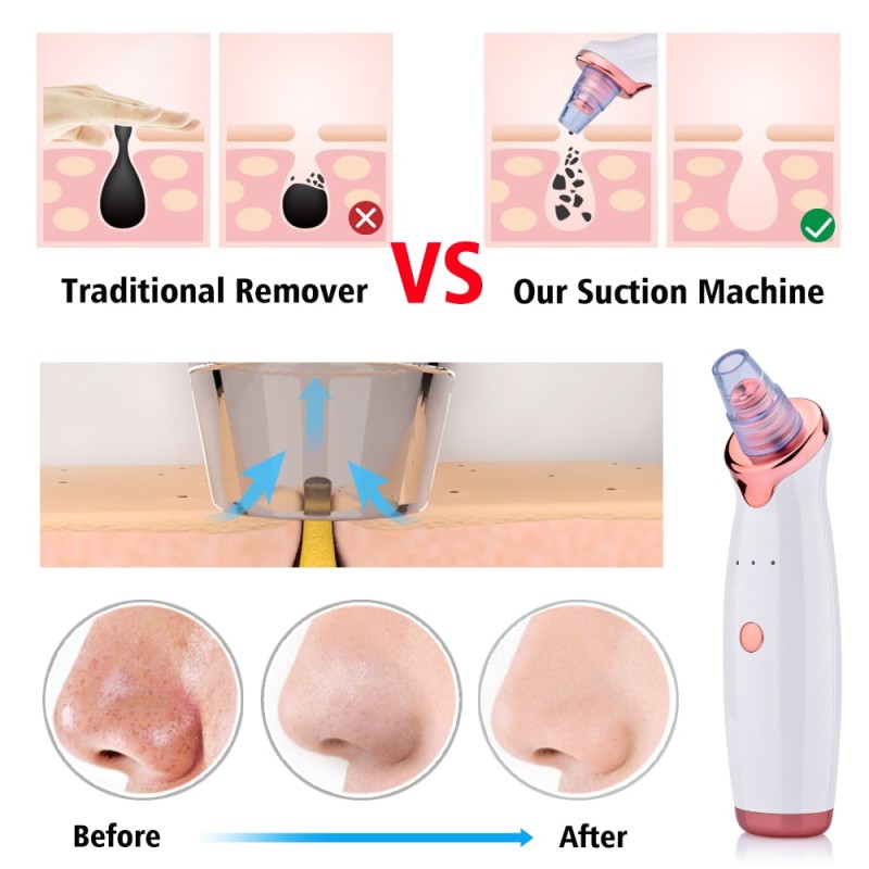 Electric Facial Blackhead Remover Vacuum Pore Cleaner Acne Cleanser Black Spots Removal Face Nose Deep Cleaning tools