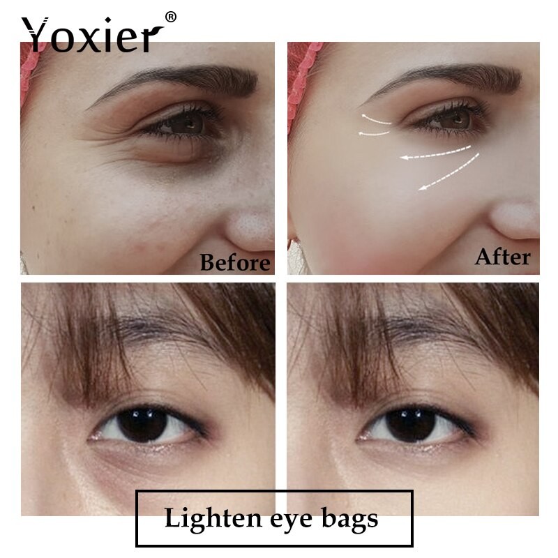 Yoxier Buy Eye Serum 10ml+Eye Cream 30g Get 1 Free Gift Anti-Aging Anti-Puffiness Fine Lines Dark Circle Moisturizing Skin Care