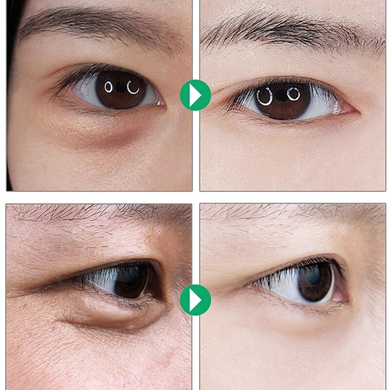 2pcs Reusable Anti Wrinkle Eye Patch Gel Anti-aging Face Pad Eye Bag Remover Fade Fine Lines Firm Lifting Silicone Mask Eye Care