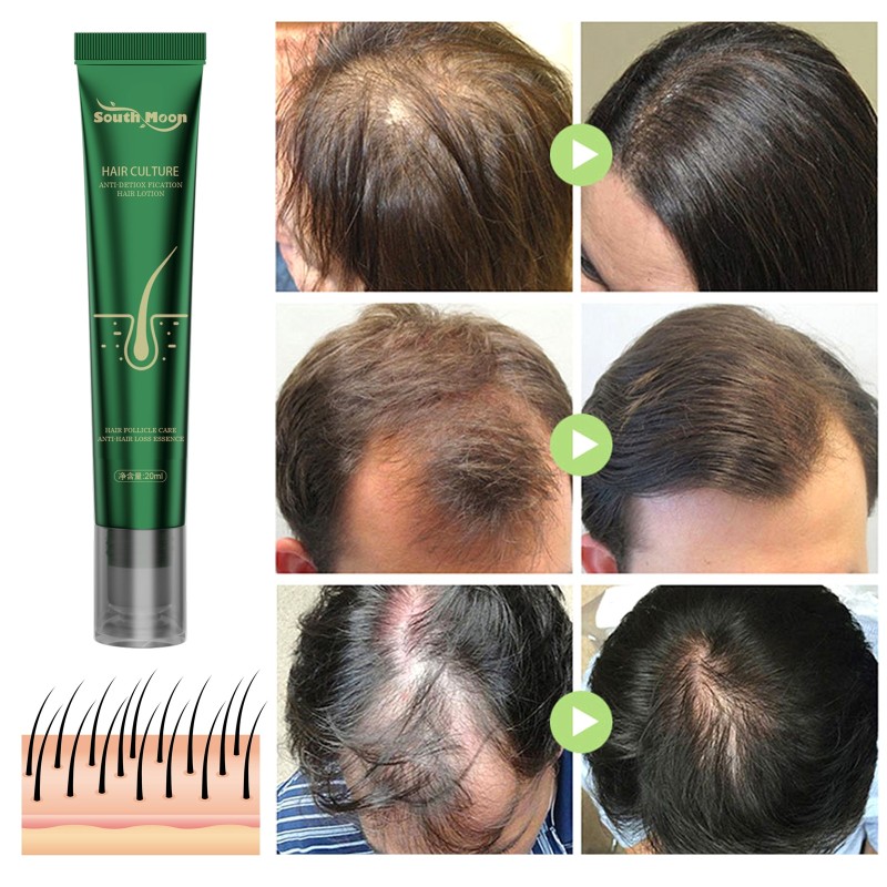 2023 Biotin Fast Hair Growth Oil Hair Regrowth Serum Hair Thinning Treatment Hair Growth Liquid Anti-Hair Loss for Women &amp; Men